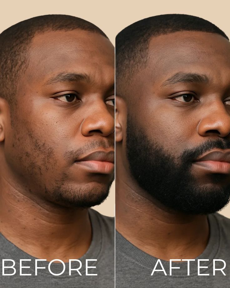 vortix™ Biotin Hair Growth Serum